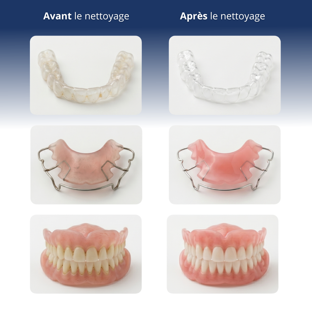 Nettoyeur à Ultrasons® dental
