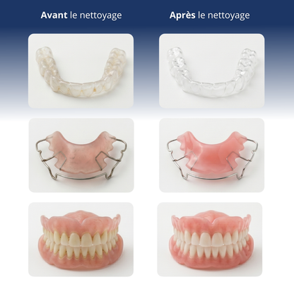 Nettoyeur à Ultrasons® dental